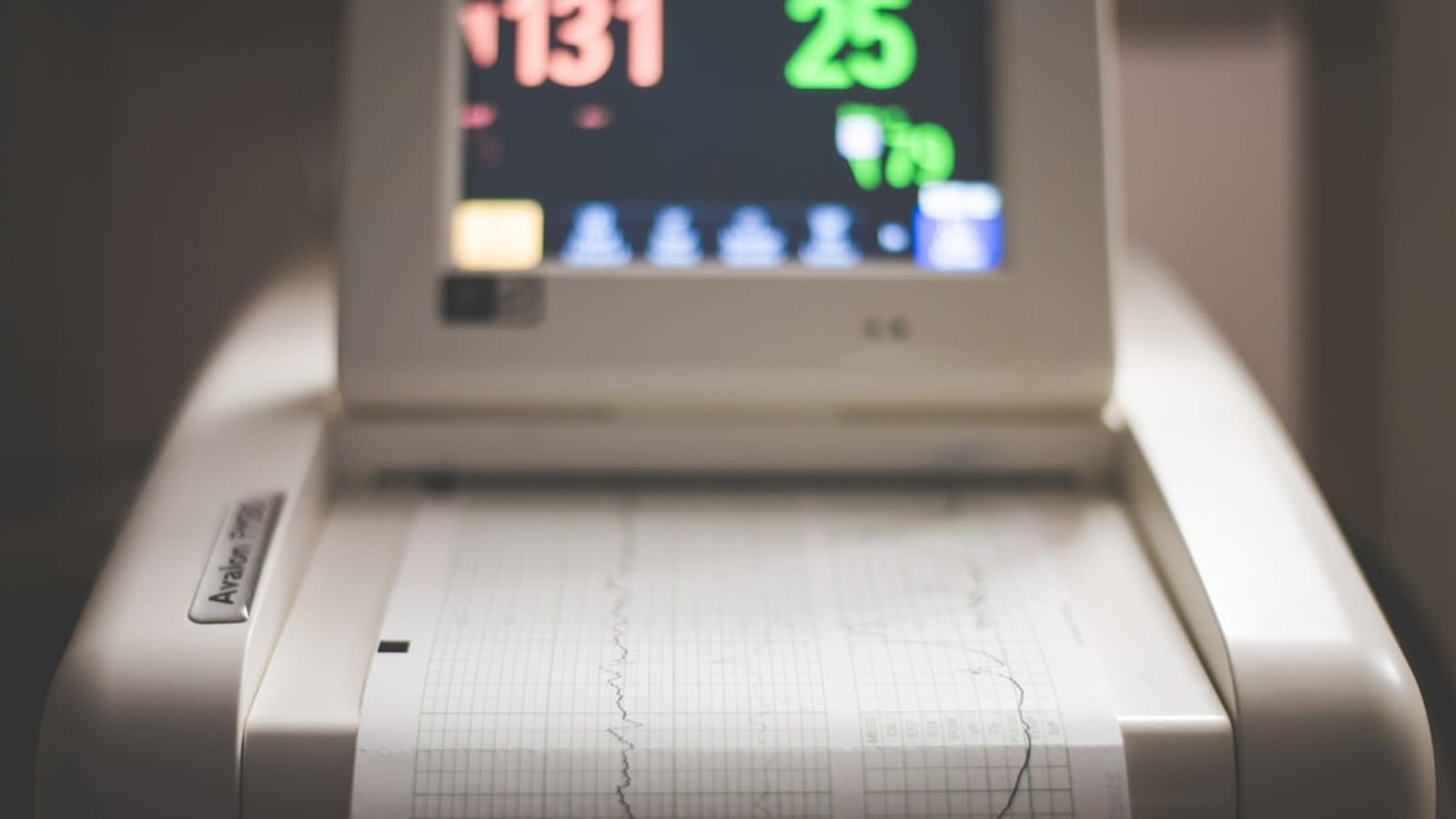 AI in HR: From Resume Screening to Predictive Attrition