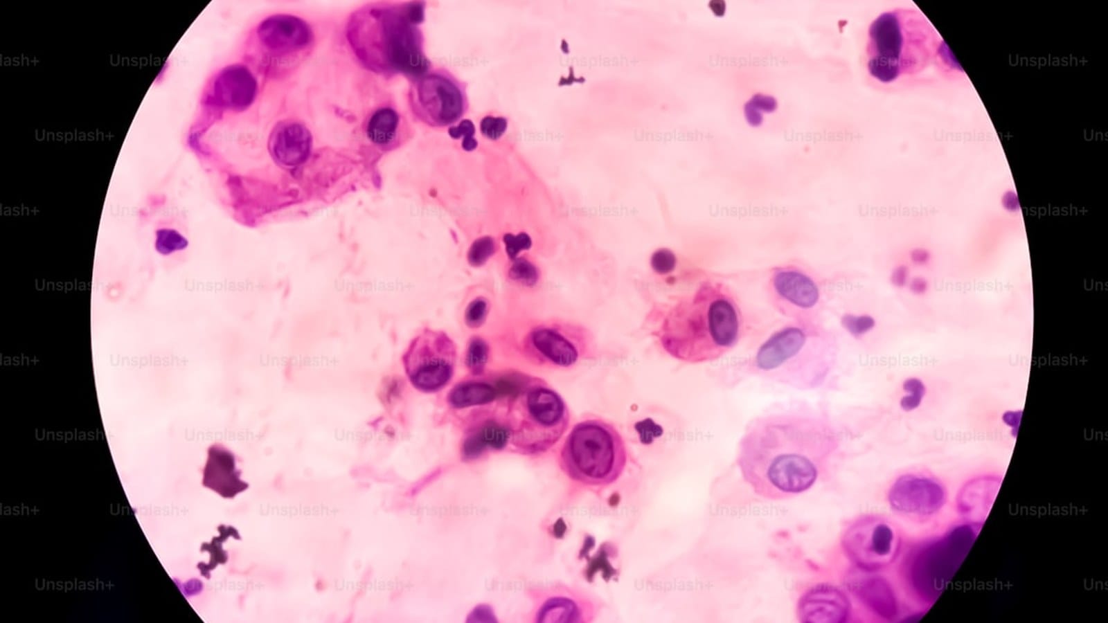 How Tempus Built a $6B Clinical AI Platform